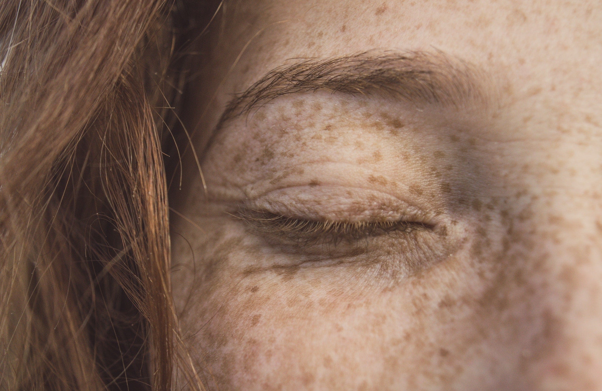 Comprehensive Guide to Chemical Exfoliants: The Secret to Rejuvenated Skin - Revoderm